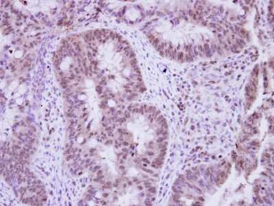 Immunohistochemistry-Paraffin: Vinexin Antibody [NBP2-20861]