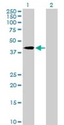 Western Blot: Vinexin Antibody [H00010174-B01P]