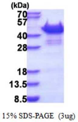 SDS-PAGE: Recombinant Human Vinexin His Protein [NBP2-51520]