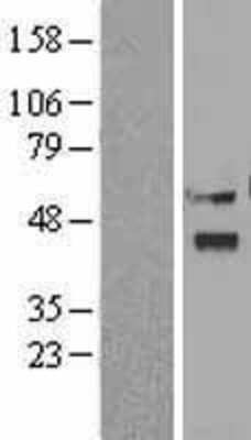 Western Blot: Viperin Overexpression Lysate [NBL1-15596]