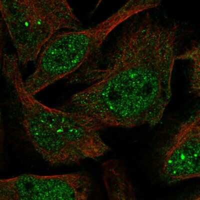 Immunocytochemistry/ Immunofluorescence: Virilizer Antibody [NBP1-85118]