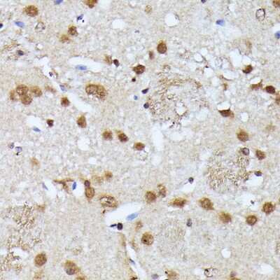 Immunohistochemistry-Paraffin: Virilizer Antibody - Azide and BSA Free [NBP2-93159]