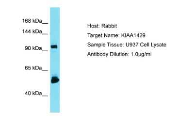 Western Blot: Virilizer Antibody [NBP2-88576]