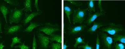 Immunocytochemistry/ Immunofluorescence: Vitamin D BP Antibody [NBP2-20863]