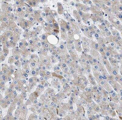 Immunohistochemistry-Paraffin: Vitamin D BP Antibody [NBP1-88027]