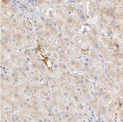 Immunohistochemistry-Paraffin: Vitamin D BP Antibody [NBP1-88028]
