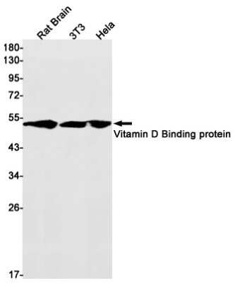 Western Blot: Vitamin D BP Antibody (S03-5G8) [NBP3-14983]