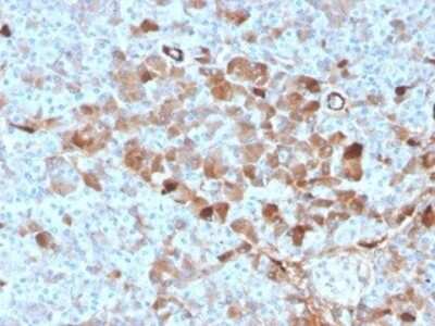 Immunohistochemistry-Paraffin: Vitamin D BP Antibody (VDBP/4482) [NBP3-13924]