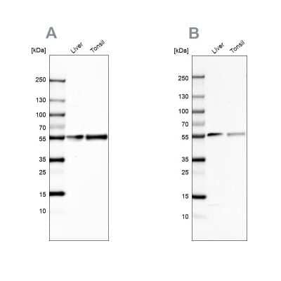 Western Blot: Vitamin D BP Antibody [NBP1-88027]