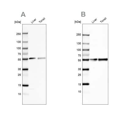 Western Blot: Vitamin D BP Antibody [NBP1-88028]