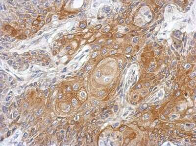 Immunohistochemistry-Paraffin: Vitamin D BP Antibody [NBP2-20863]