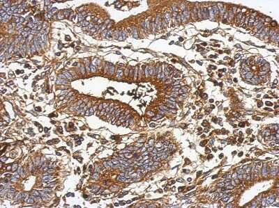 Immunohistochemistry-Paraffin: Vitamin D BP Antibody [NBP2-20864]