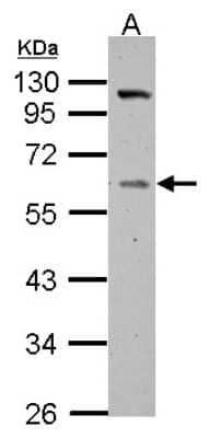 Western Blot: Vitamin D BP Antibody [NBP2-20863]