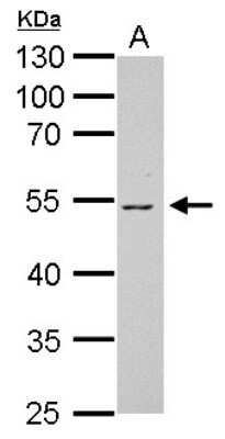 Western Blot: Vitamin D BP Antibody [NBP2-20863]