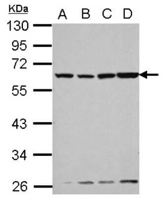 Western Blot: Vitamin D BP Antibody [NBP2-20864]