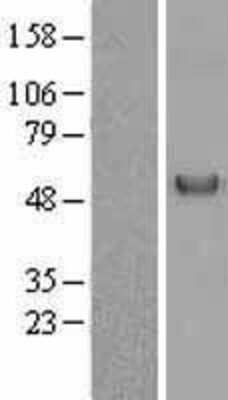 Western Blot: Vitamin D BP Overexpression Lysate [NBL1-10999]