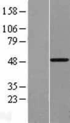 Western Blot: VDR/NR1I1/Vitamin D Receptor Overexpression Lysate [NBL1-17711]