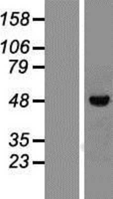 Western Blot: VDR/NR1I1/Vitamin D Receptor Overexpression Lysate [NBP2-11216]