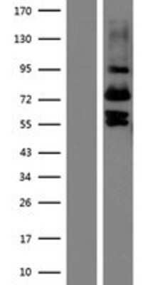 Western Blot: Vitrin Overexpression Lysate [NBP2-11460]