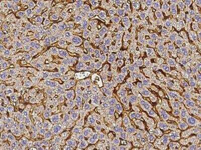 Immunohistochemistry-Paraffin: Vitronectin Antibody (019) [NBP2-90648]