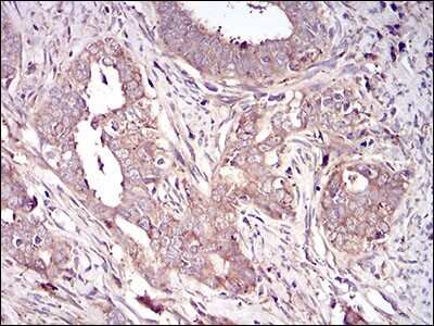 Immunohistochemistry-Paraffin: Vitronectin Antibody (1G11E8) - BSA Free [NBP2-52586]
