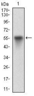 Western Blot: Vitronectin Antibody (1G11E8)BSA Free [NBP2-52586]