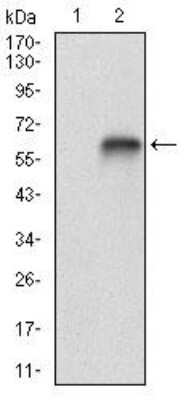Western Blot: Vitronectin Antibody (1G11E8)BSA Free [NBP2-52586]