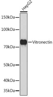 Western Blot: Vitronectin Antibody (2V2V8) [NBP3-16498]