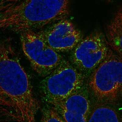 Immunocytochemistry/ Immunofluorescence: Vitronectin Antibody [NBP2-38901]