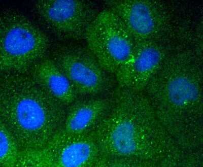 Immunocytochemistry/ Immunofluorescence: Vitronectin Antibody (ST49-02) [NBP2-67511]