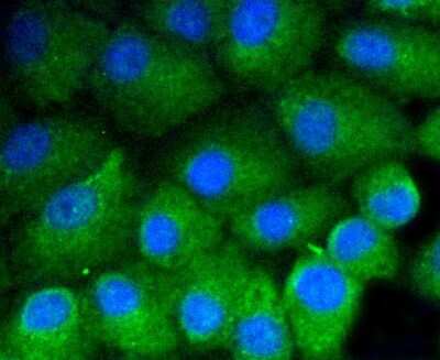 Immunocytochemistry/ Immunofluorescence: Vitronectin Antibody (ST49-02) [NBP2-67511]