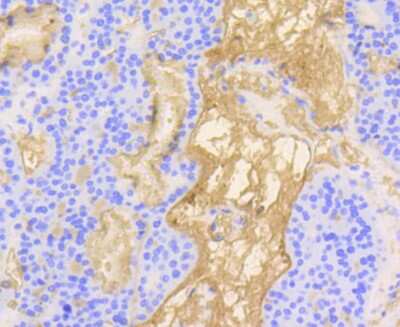 Immunohistochemistry-Paraffin: Vitronectin Antibody (ST49-02) [NBP2-67511]
