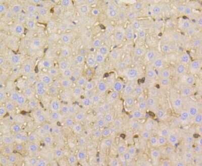 Immunohistochemistry-Paraffin: Vitronectin Antibody (ST49-02) [NBP2-67511]