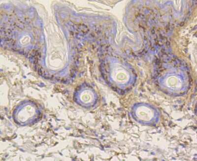 Immunohistochemistry-Paraffin: Vitronectin Antibody (ST49-02) [NBP2-67511]