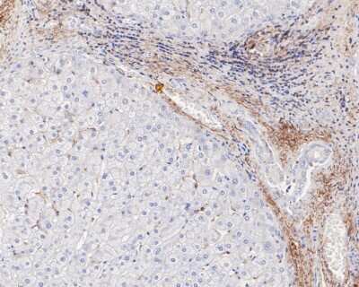 Immunohistochemistry-Paraffin: Vitronectin Antibody (ST49-02) [NBP2-67511]