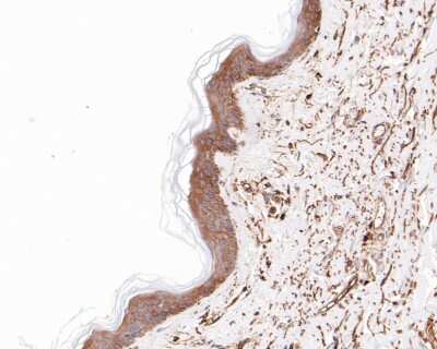 Immunohistochemistry-Paraffin: Vitronectin Antibody (ST49-02) [NBP2-67511]