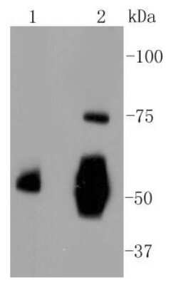 Western Blot: Vitronectin Antibody (ST49-02) [NBP2-67511]