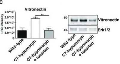 Western Blot: Vitronectin Antibody [NBP2-20866]