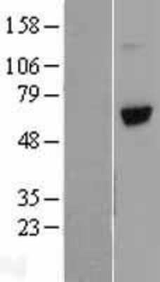 Western Blot: Vitronectin Overexpression Lysate [NBL1-17770]