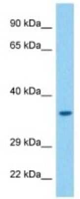 Western Blot: Vomeronasal 1 receptor 41 Antibody [NBP3-10264]