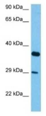 Western Blot: Vomeronasal 1 receptor 54 Antibody [NBP3-10245]