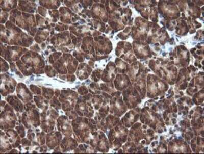 Immunohistochemistry: Von Hippel Lindau Antibody (OTI1E1) [NBP2-45411]