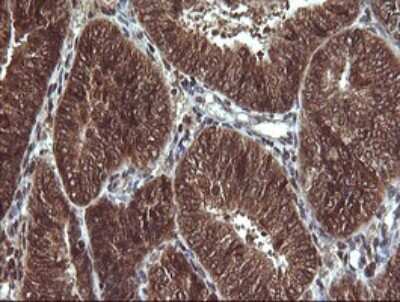 Immunohistochemistry: Von Hippel Lindau Antibody (OTI1E1) [NBP2-45411]