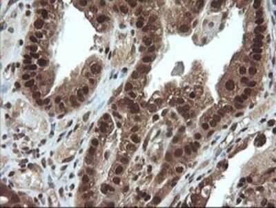 Immunohistochemistry: Von Hippel Lindau Antibody (OTI1E1) [NBP2-45411]