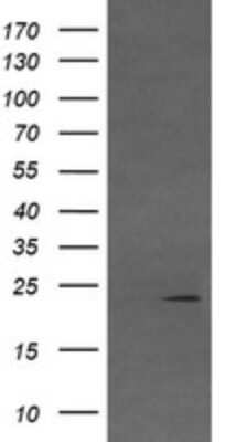 Western Blot: Von Hippel Lindau Antibody (OTI1E1) [NBP2-45411]