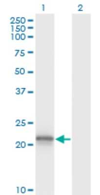 Western Blot: Von Hippel Lindau Antibody (1G12) [H00007428-M01]