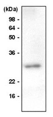 Western Blot: Von Hippel Lindau Antibody (AT82B10)BSA Free [NBP1-04355]