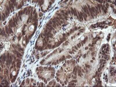 Immunohistochemistry: Von Hippel Lindau Antibody (OTI1E1) - Azide and BSA Free [NBP2-74851]