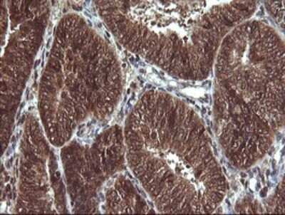 Immunohistochemistry: Von Hippel Lindau Antibody (OTI1E1) - Azide and BSA Free [NBP2-74851]