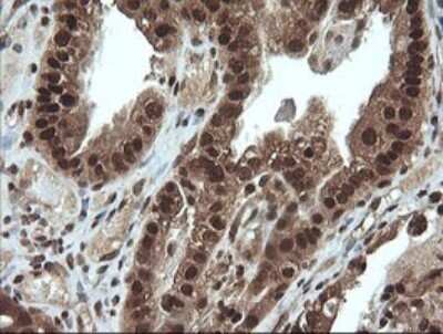 Immunohistochemistry: Von Hippel Lindau Antibody (OTI1E1) - Azide and BSA Free [NBP2-74851]